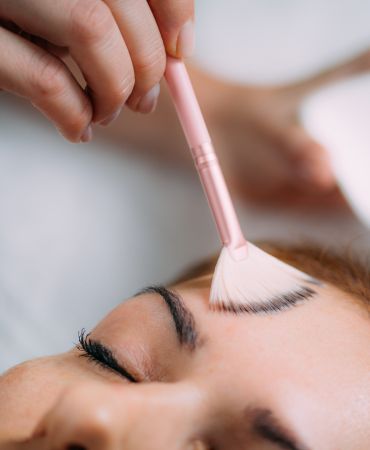 Chemical Peeling by Dr. Chaitali Mondal in Kolkata (1) Chemical-Peeling-by-Dr Chemical-Peeling-by-Dr Chemical Peeling by Dr. Chaitali Mondal in Kolkata Chemical Peeling Chemical Peeling by Dr