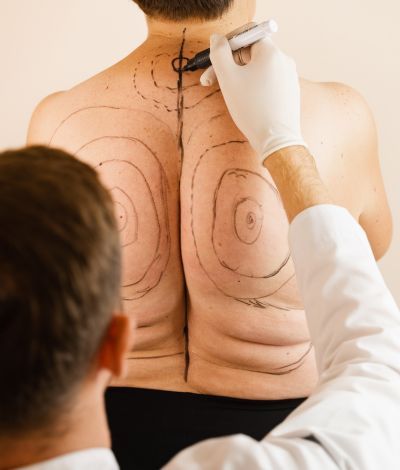 NON SURGICAL LIPOSUCTION in kolkata (1) NON-SURGICAL-LIPOSUCTION-in-kolkata-1 NON-SURGICAL-LIPOSUCTION-in-kolkata-1 Non Surgical Liposuction NON SURGICAL LIPOSUCTION in kolkata 1