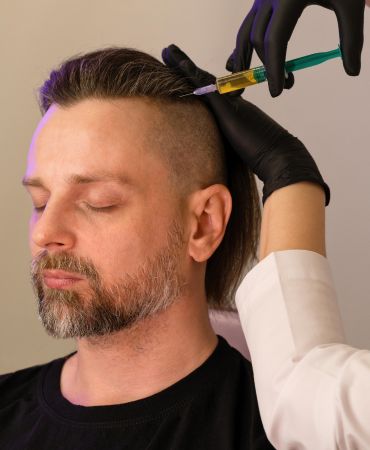 PRP AND Mesotherapy by Dr. Chaitali Mondal in Kolkata (1) PRP-AND-Mesotherapy-by-Dr PRP-AND-Mesotherapy-by-Dr PRP AND Mesotherapy PRP AND Mesotherapy by Dr