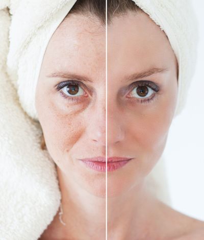 SKIN REJUVENATION in kolkata SKIN-REJUVENATION-in-kolkata SKIN-REJUVENATION-in-kolkata Skin Rejuvenation SKIN REJUVENATION in kolkata
